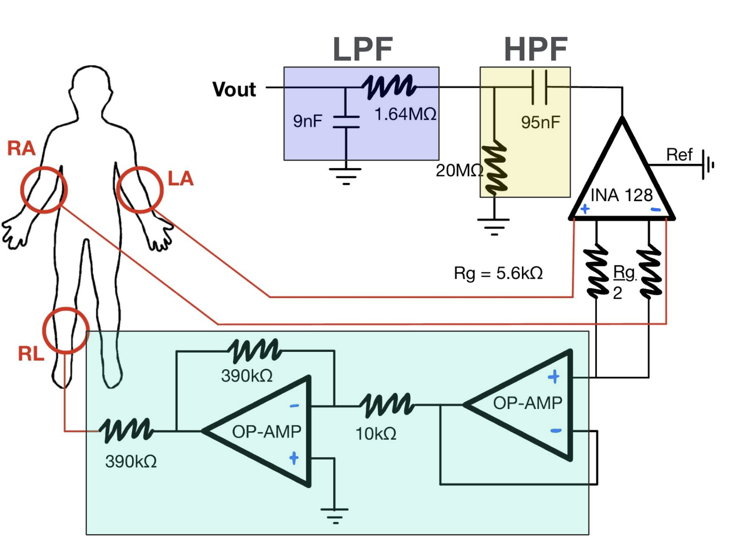 Diagram of ECG with electrodes placed on the human body at the right arm, right leg, and left arm.
