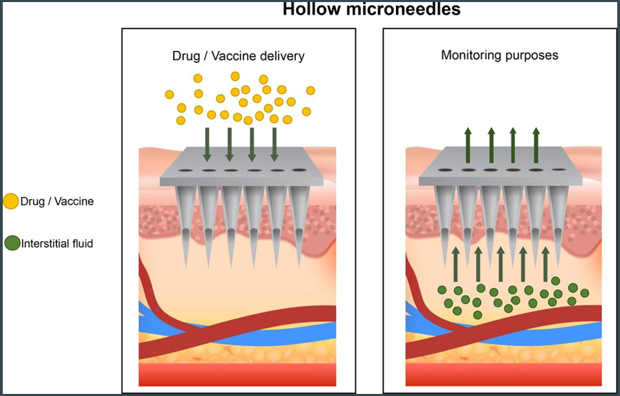 Diagram showing hollow microneedles used for drug or vaccine delivery and monitoring purposes. The left side illustrates drug/vaccine particles passing through the microneedles into the skin, while the right side shows interstitial fluid moving through the microneedles for monitoring.