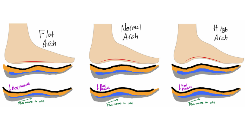 Comparison of flat, normal, and high arches in feet, showing heel pressure and fluid flow movement across the arch.