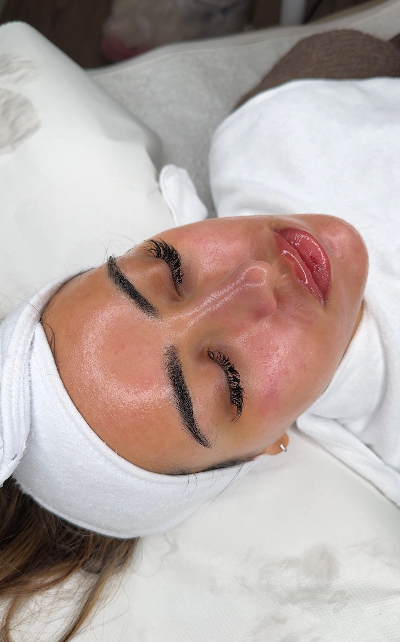 A woman lying down with her eyes closed, wearing a headband, undergoing a facial treatment at a spa or clinic.