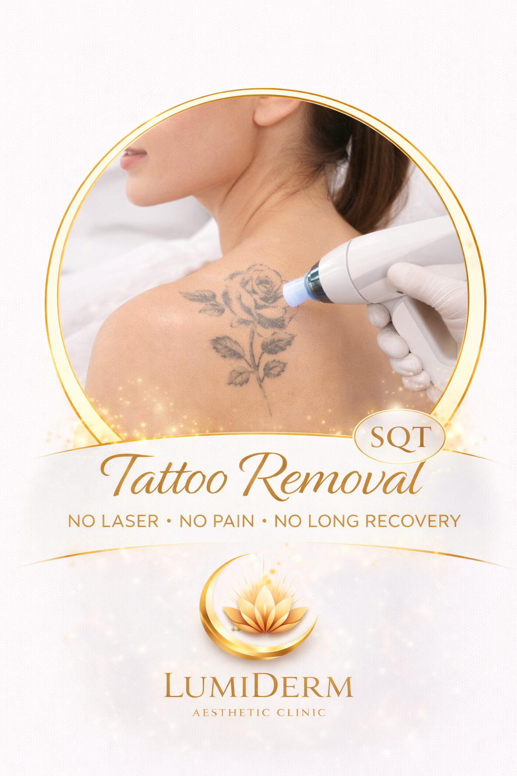 Tattoo Removal