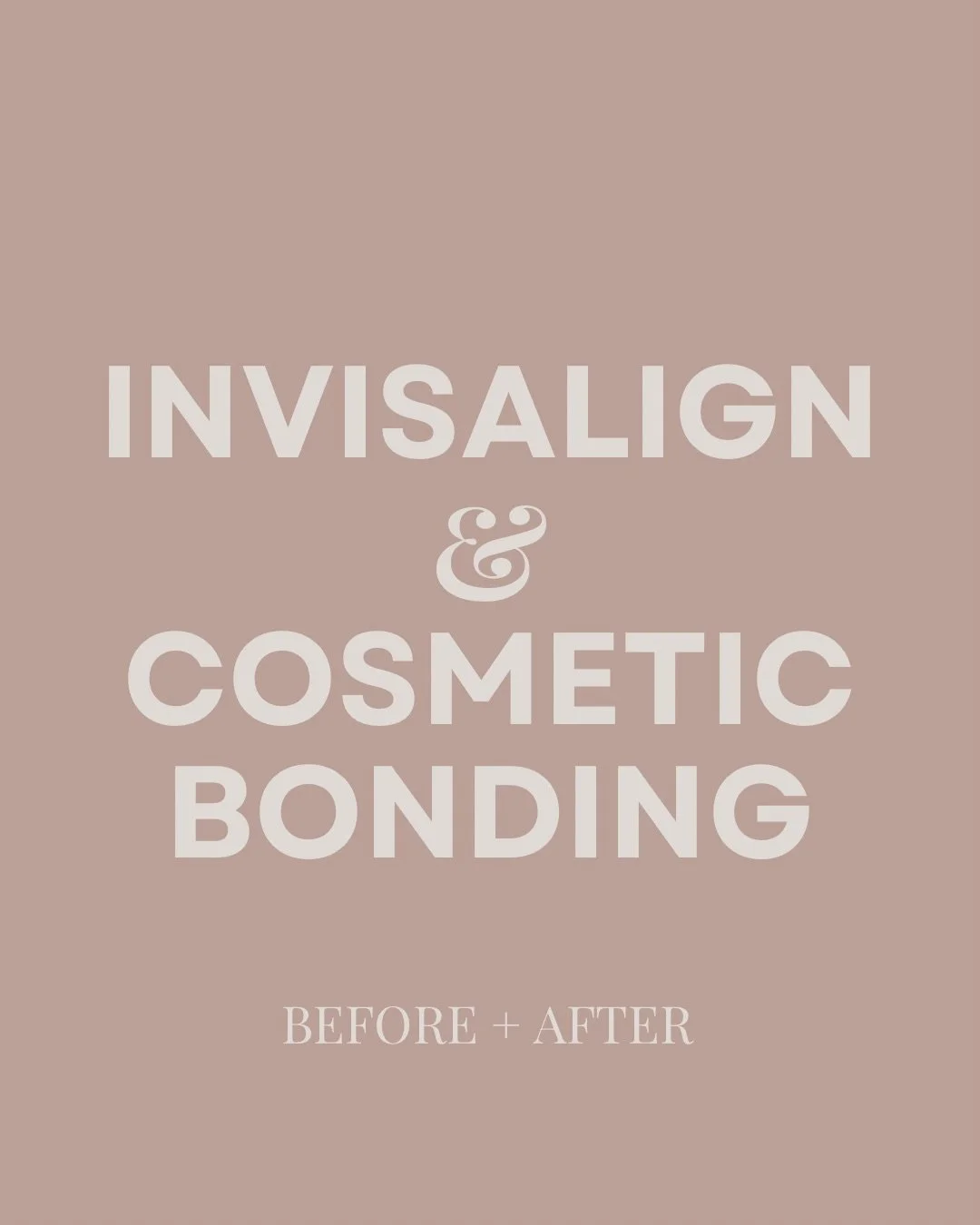 What happens when you take a crowded arch, a gummy smile, and misalignment&hellip; and treat them properly?
You get a wider, healthier arch, beautifully aligned teeth, a softened gummy smile - and yes, even a subtle lift through the jowl + lower face