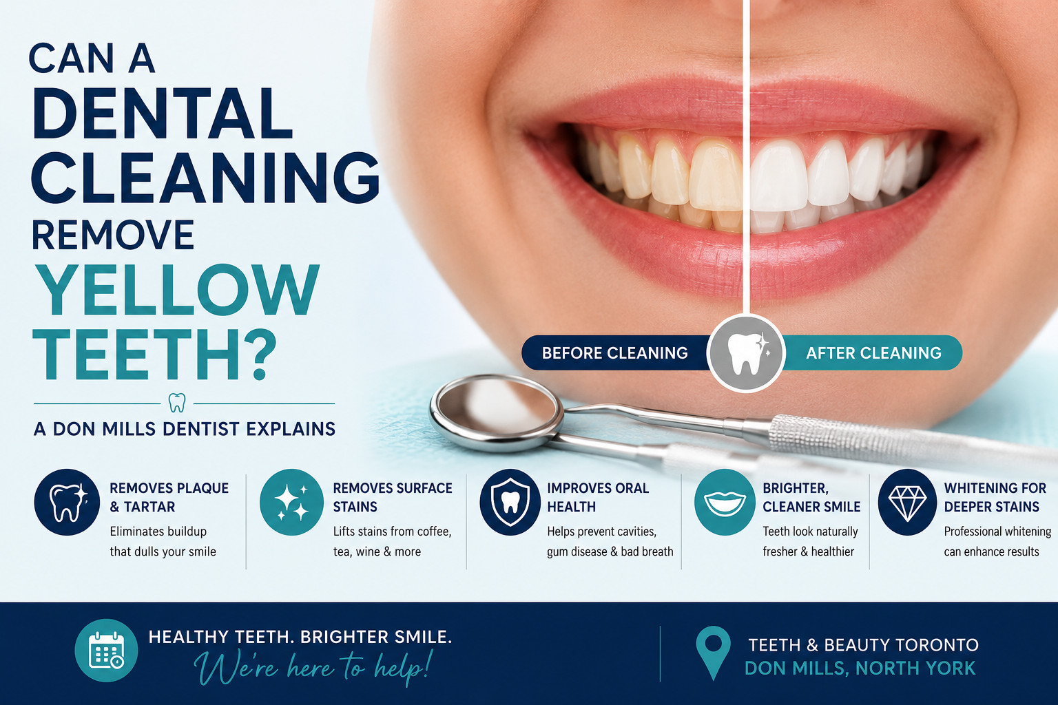 Can a Dental Cleaning Remove Yellow Teeth? A Don Mills Dentist Explains