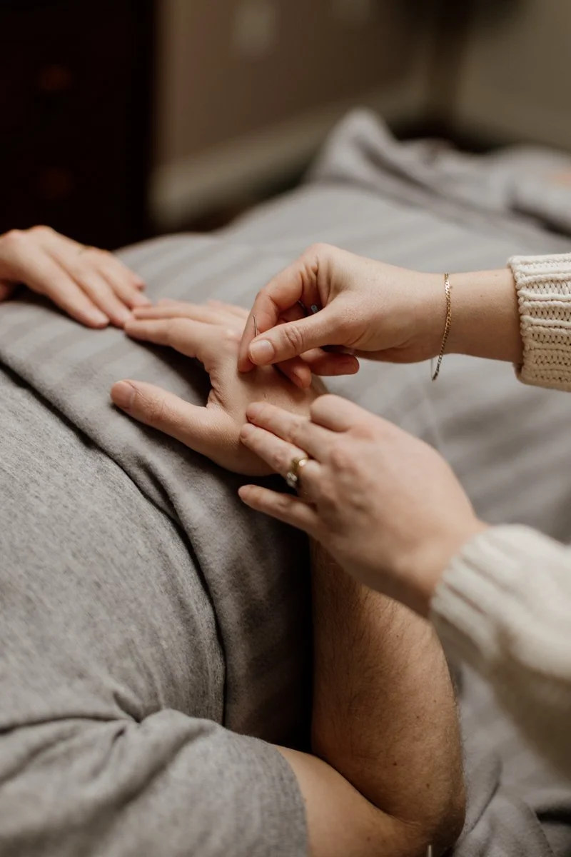 Acupuncturist Kelly Baucum applying gentle acupuncture to a patient's hand. Kelly is trained in the Japanese style of acupuncture, a gentle and refined practice using very small gauges of needles inserted to a very shallow depth.