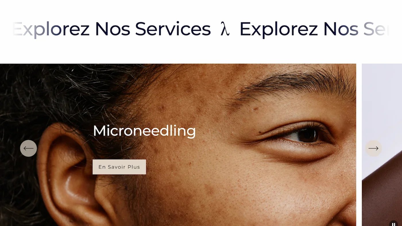 Close-up of a person's face showing brown skin with pigmentation issues, focusing on the eye and cheek area, with the text "Microneedling" overlaid.