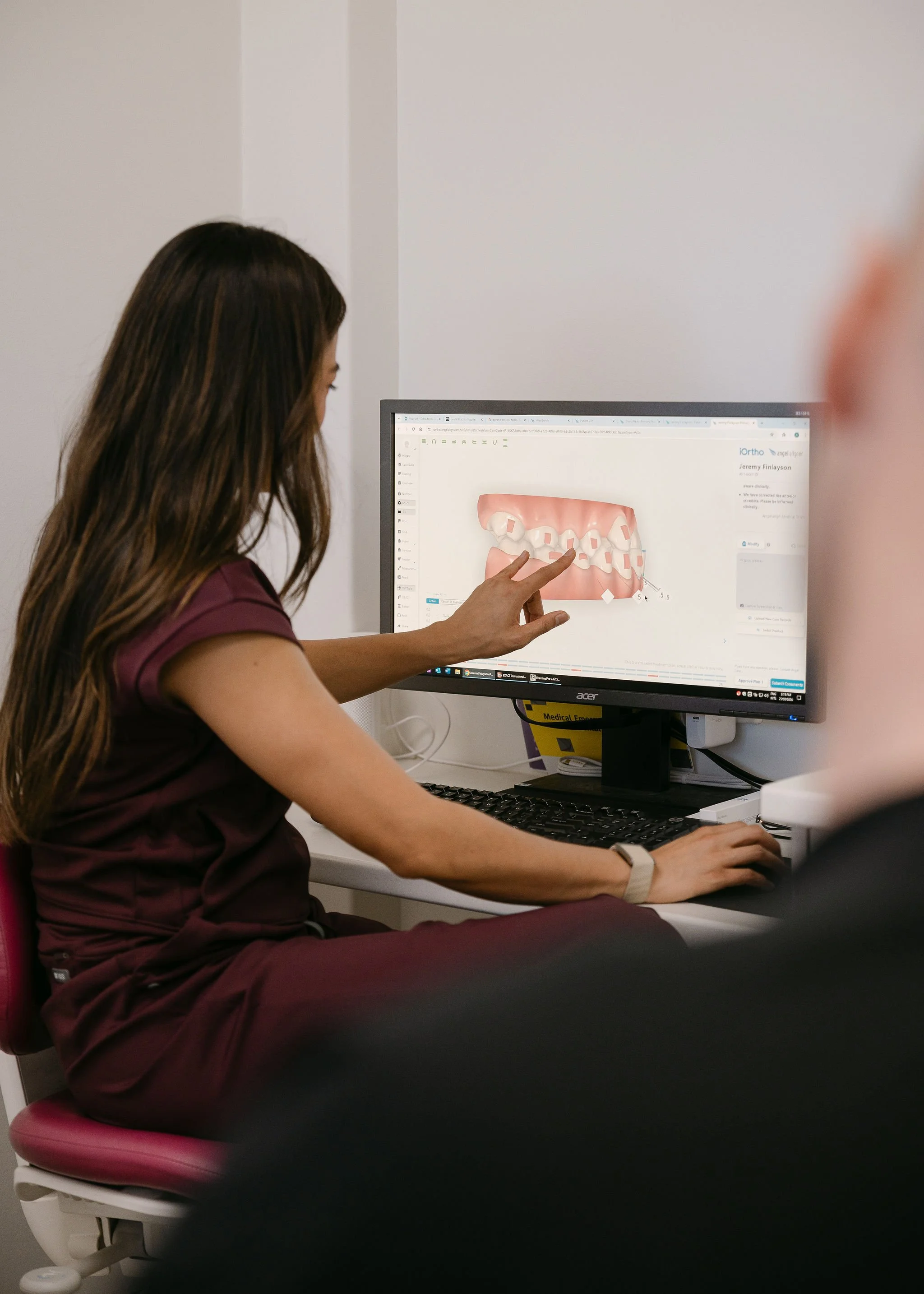 A woman in scrubs sitting at a desk, pointing to a digital 3D model of teeth and gums on a computer monitor.
