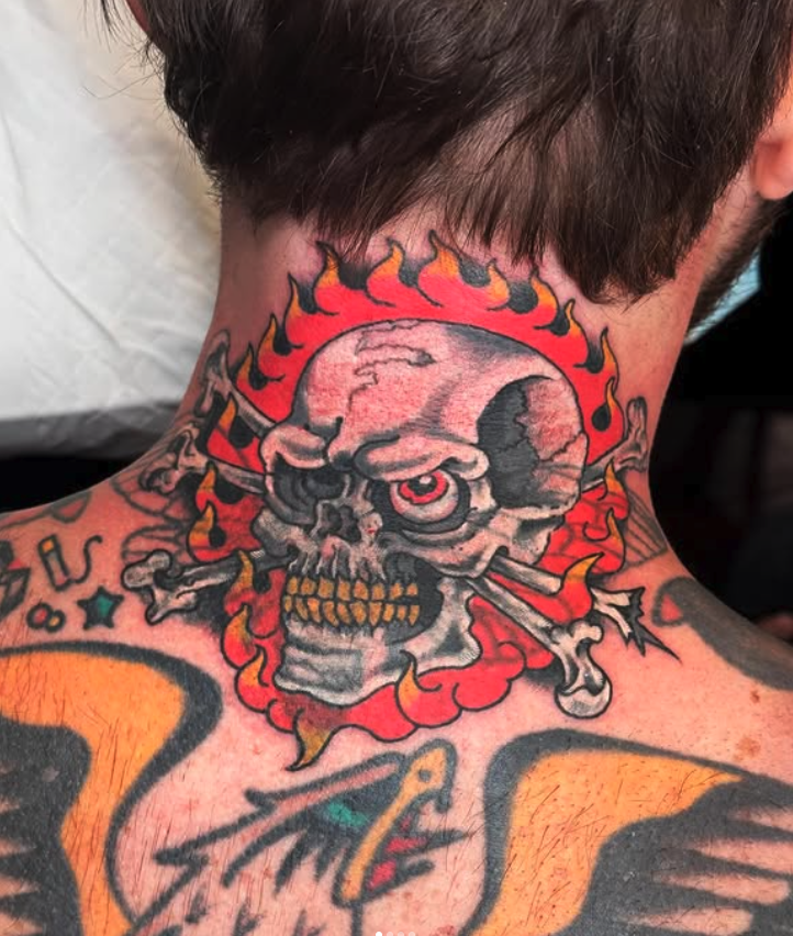 Tattoo of a skull with a burn scar, crossbones, and a red eye, surrounded by flames on a person's neck and shoulder.