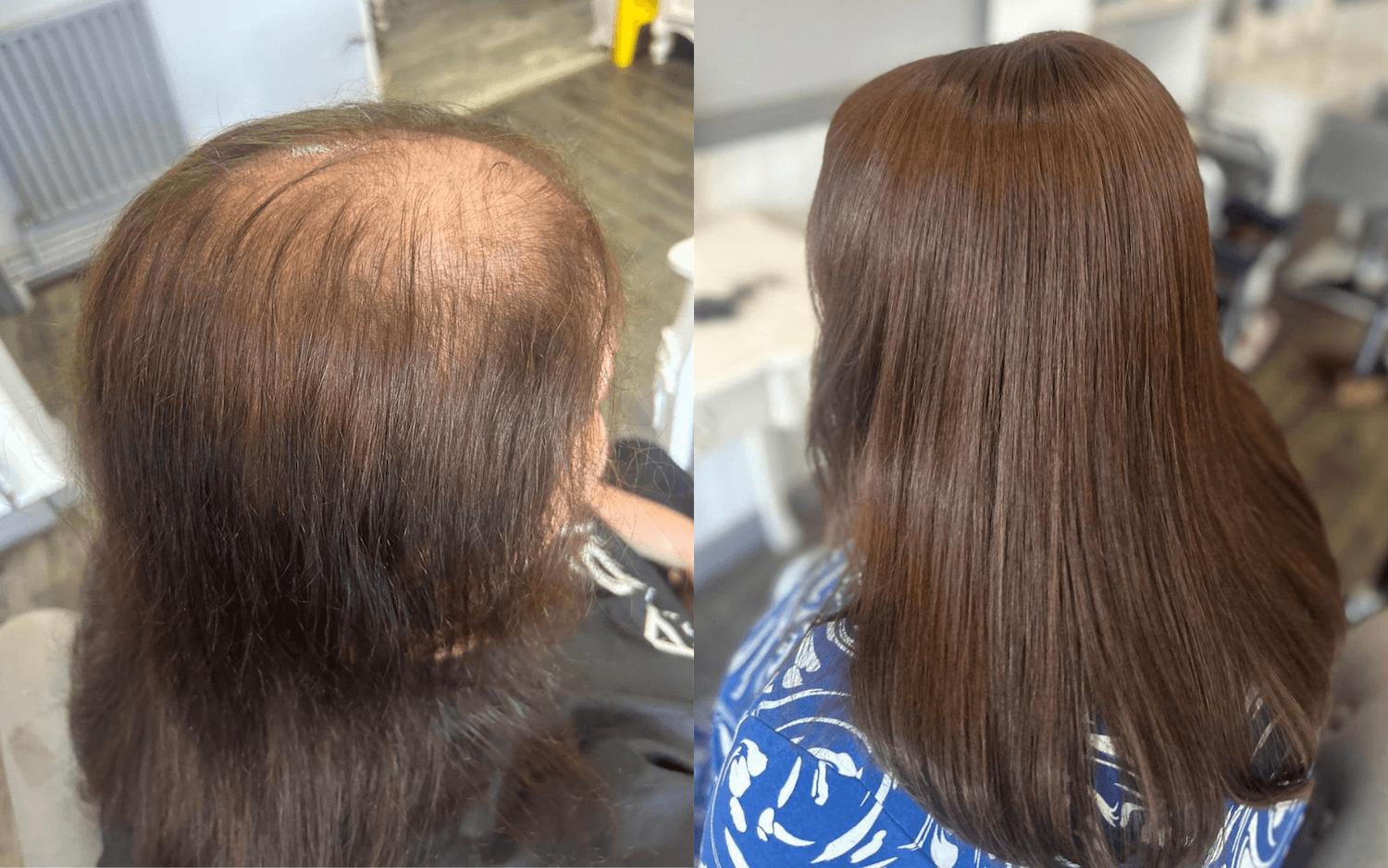 Side-by-side comparison of a woman's hair before and after a professional hair treatment. On the left, the hair is thin, frizzy, and showing significant hair loss at the crown. On the right, the hair appears thick, smooth, and shiny, with a natural brown color.