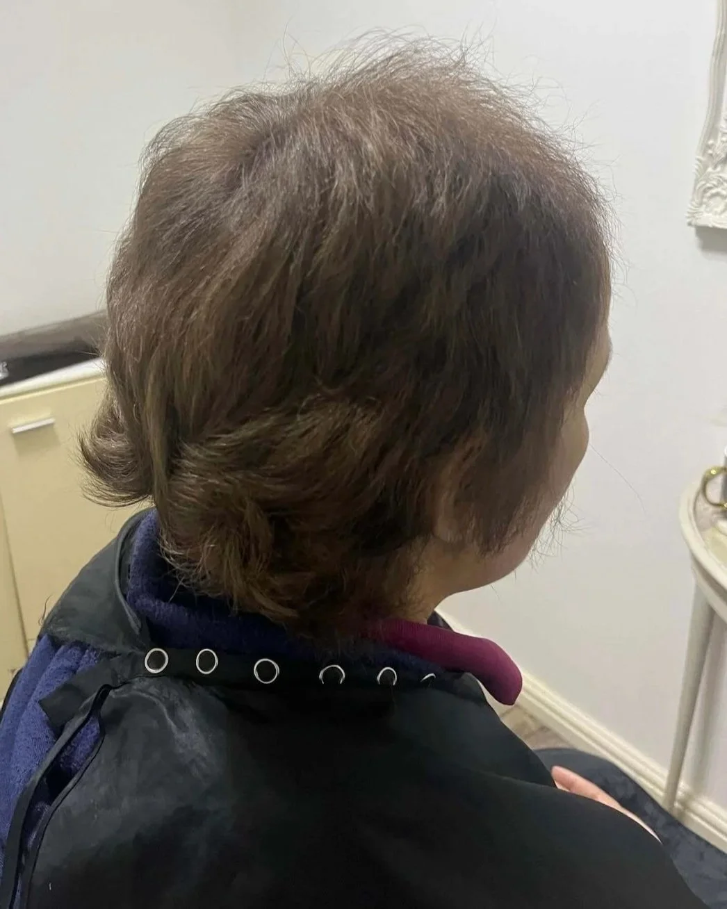 Before Mesh Integration - Hair Loss Specialist Ruth Lynch 1.jpg