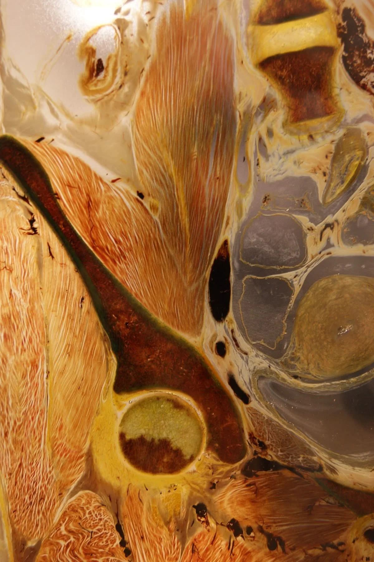 NAD+ and Parkinson’s Disease — Early Clinical Evidence for Neuroprotection