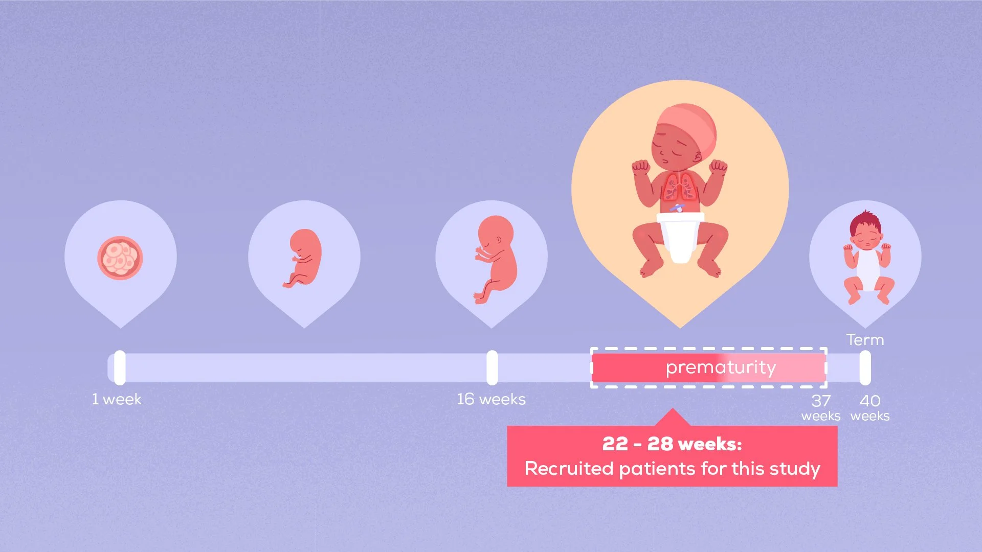 Timeline of fetal development from 1 week to term, with a focus on 22 to 28 weeks when patients are recruited for a study, highlighting premature birth.