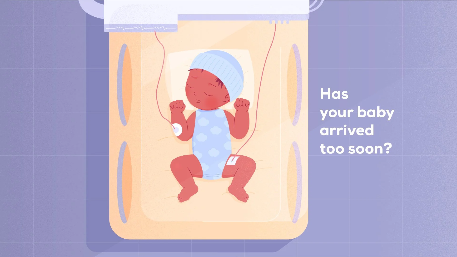 A cartoon baby lying in a hospital bed connected to medical wires, wearing a striped cap and a blue onesie with clouds. The baby appears to be sleeping or unresponsive. The background is purple with a partial text reading, 'Has your baby arrived too 