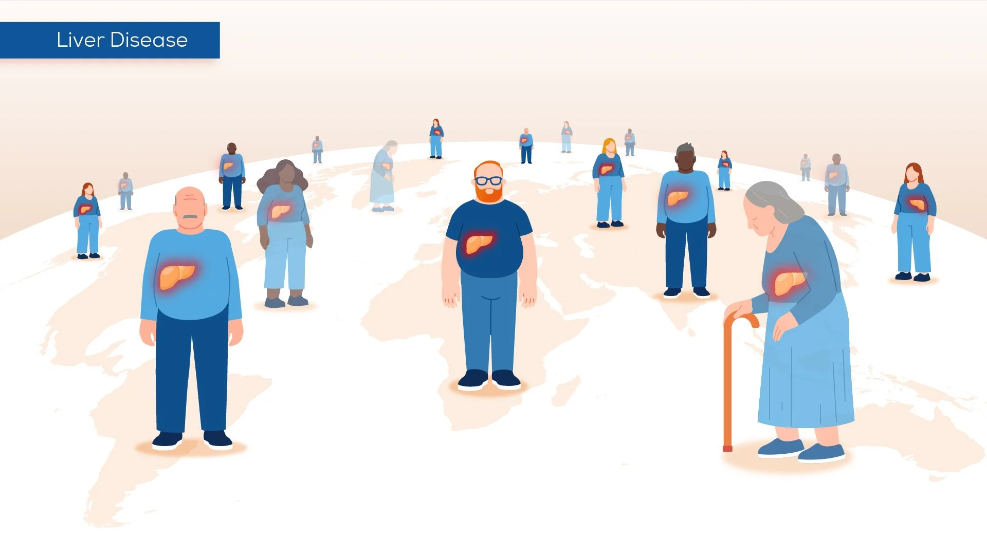 Illustration showing people around the world with liver images on their shirts, representing global awareness of liver disease.