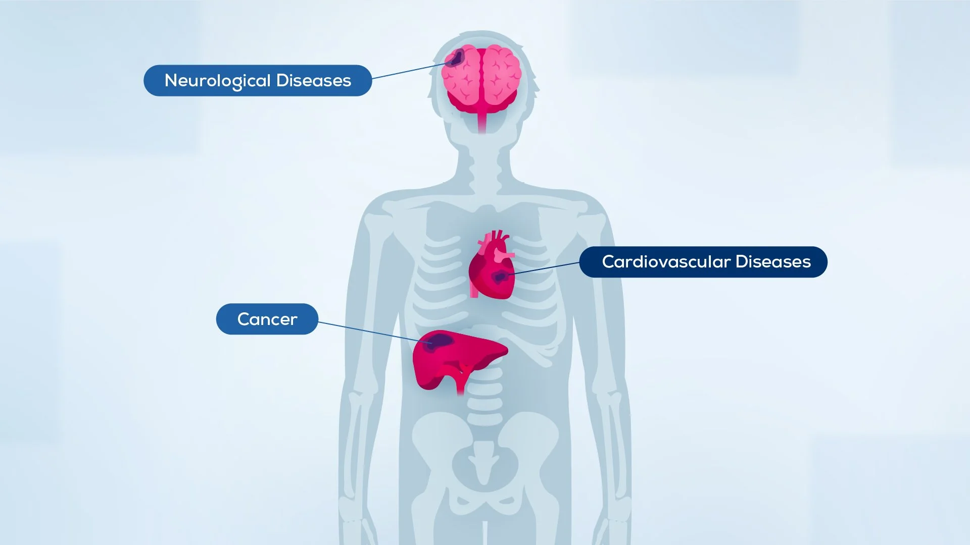 A human body diagram highlighting different disease categories: neurological diseases in the brain, cardiovascular diseases in the heart, and cancer in the liver.