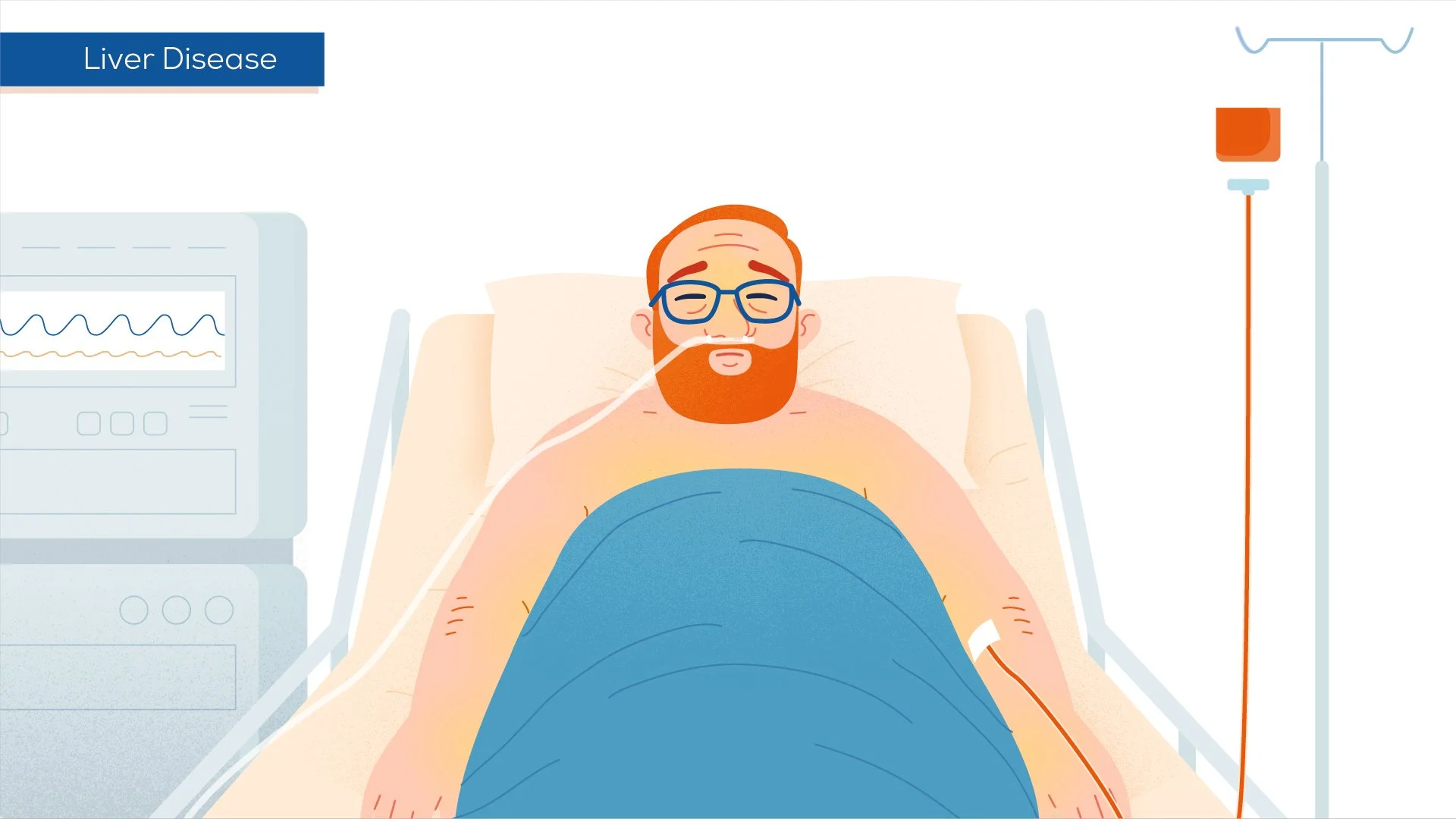 An illustration of a man with a beard and glasses lying in a hospital bed with oxygen support, connected to medical equipment, indicating he has liver disease.