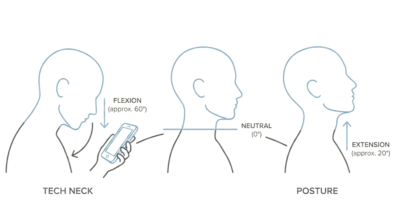 Neck Flexion and Tech Neck representation