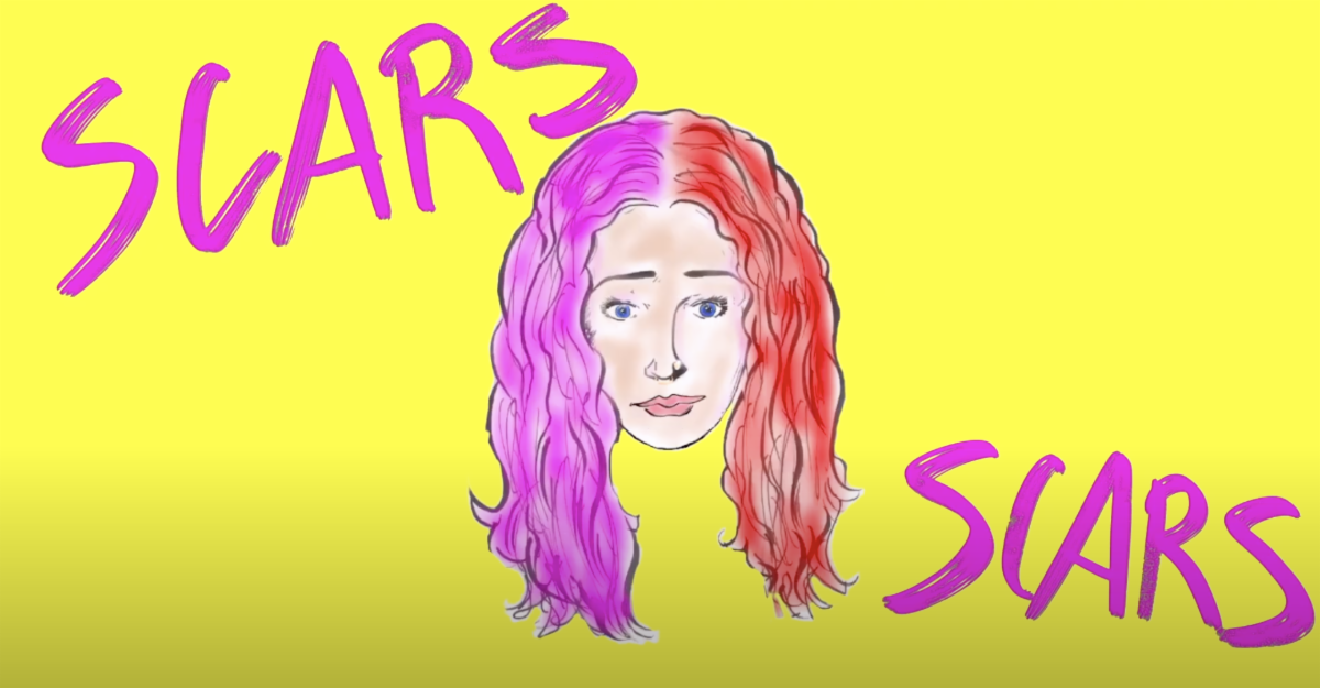 Kick-ass Rising Artist Tera Lynne Fister Premieres Lyric Video for SCARS Exclusively on Center Stage Magazine