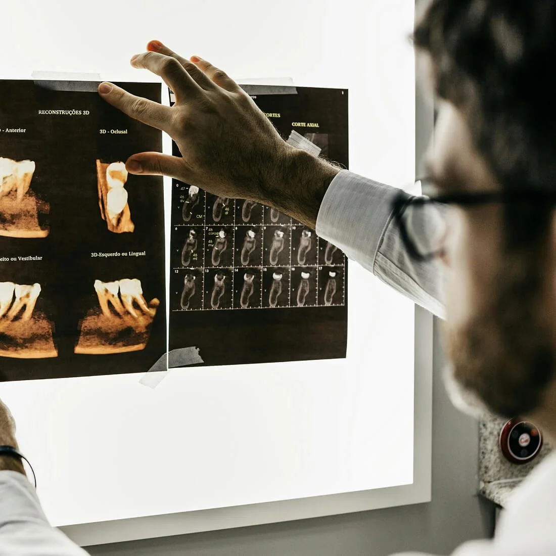 Healthcare professional reviewing diagnostic imaging scans on a computer screen.