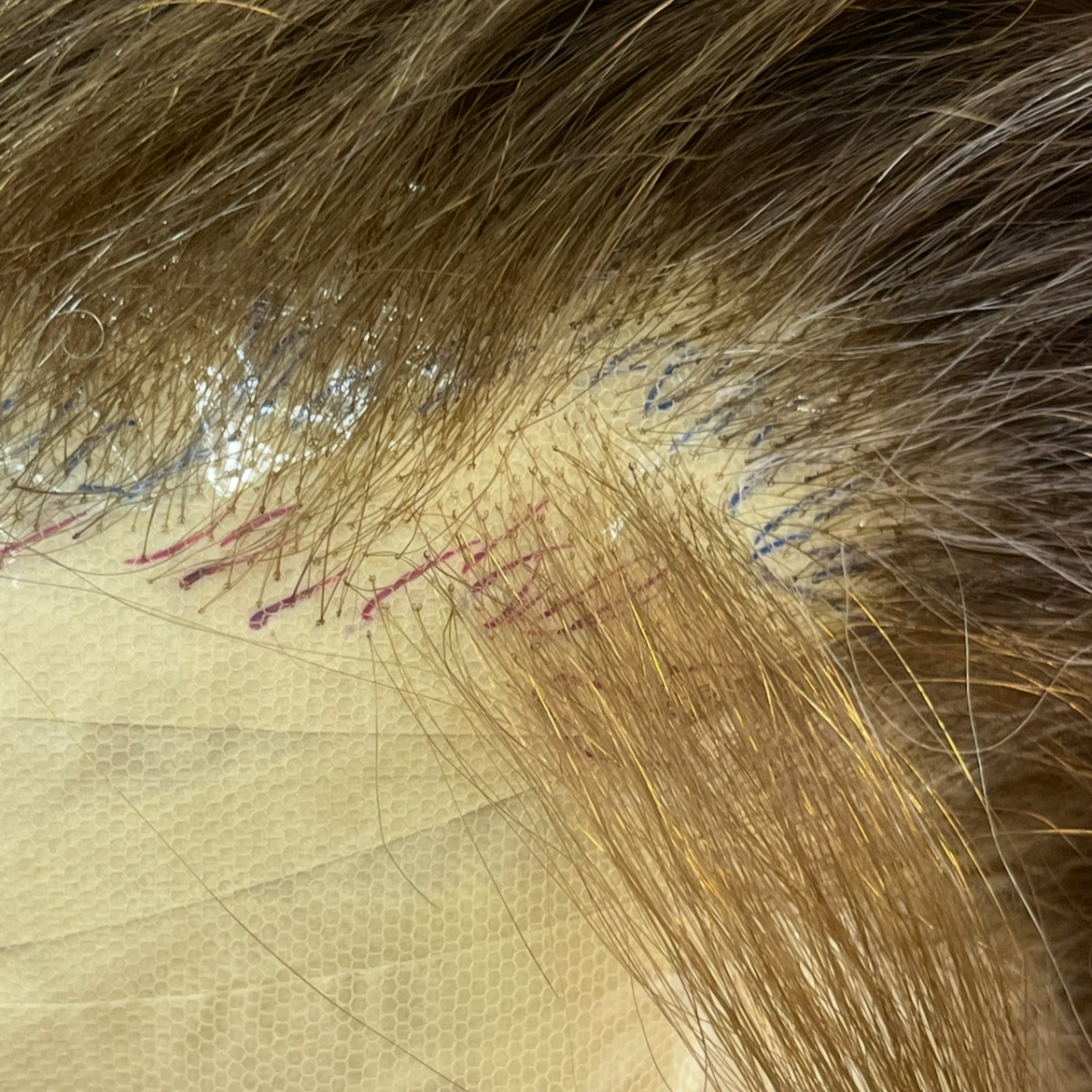 Ventilating & Foundation Building