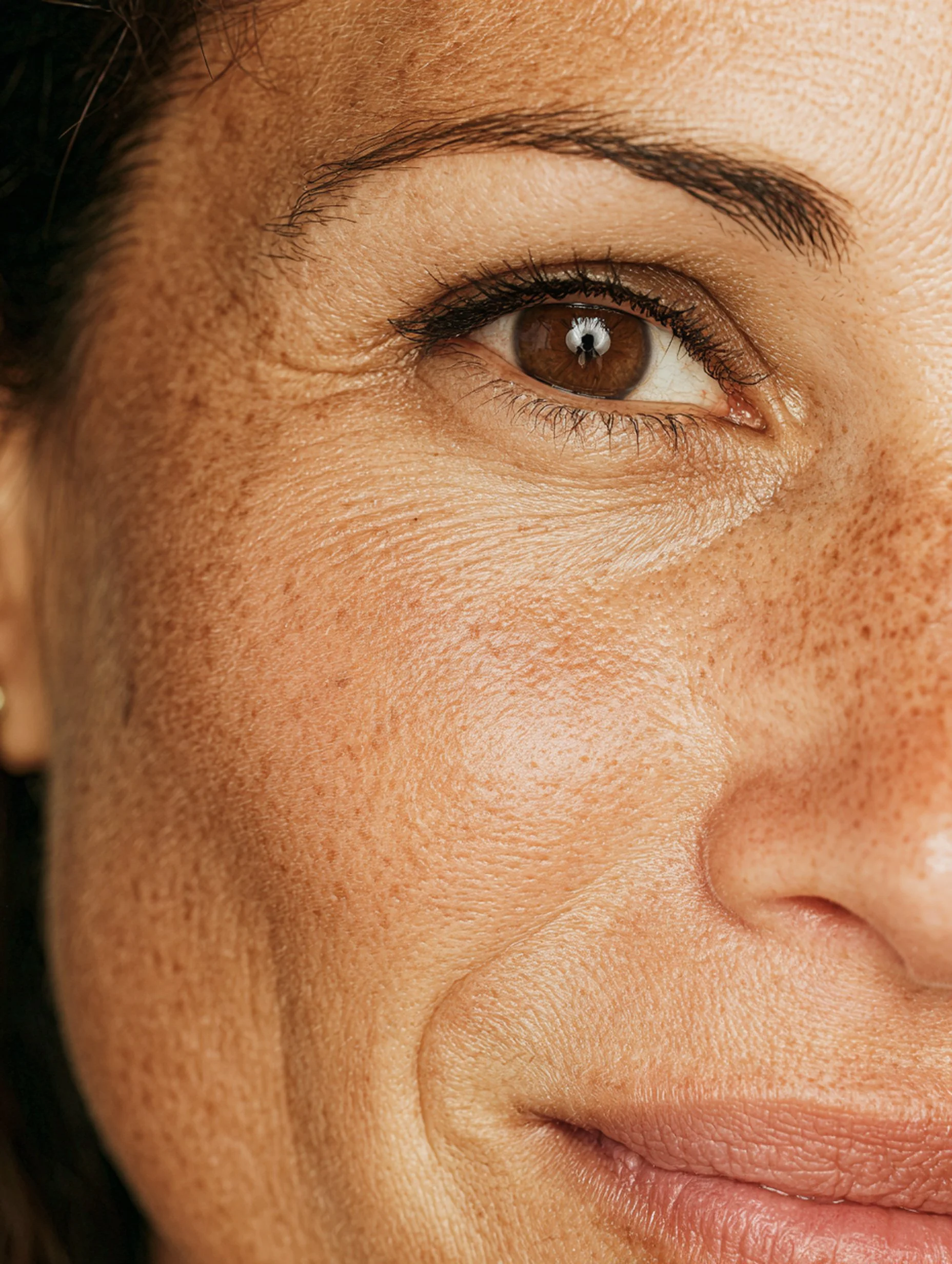 Medspa in Nanuet, NY, 10954 | Under Eye Restoration Near Me