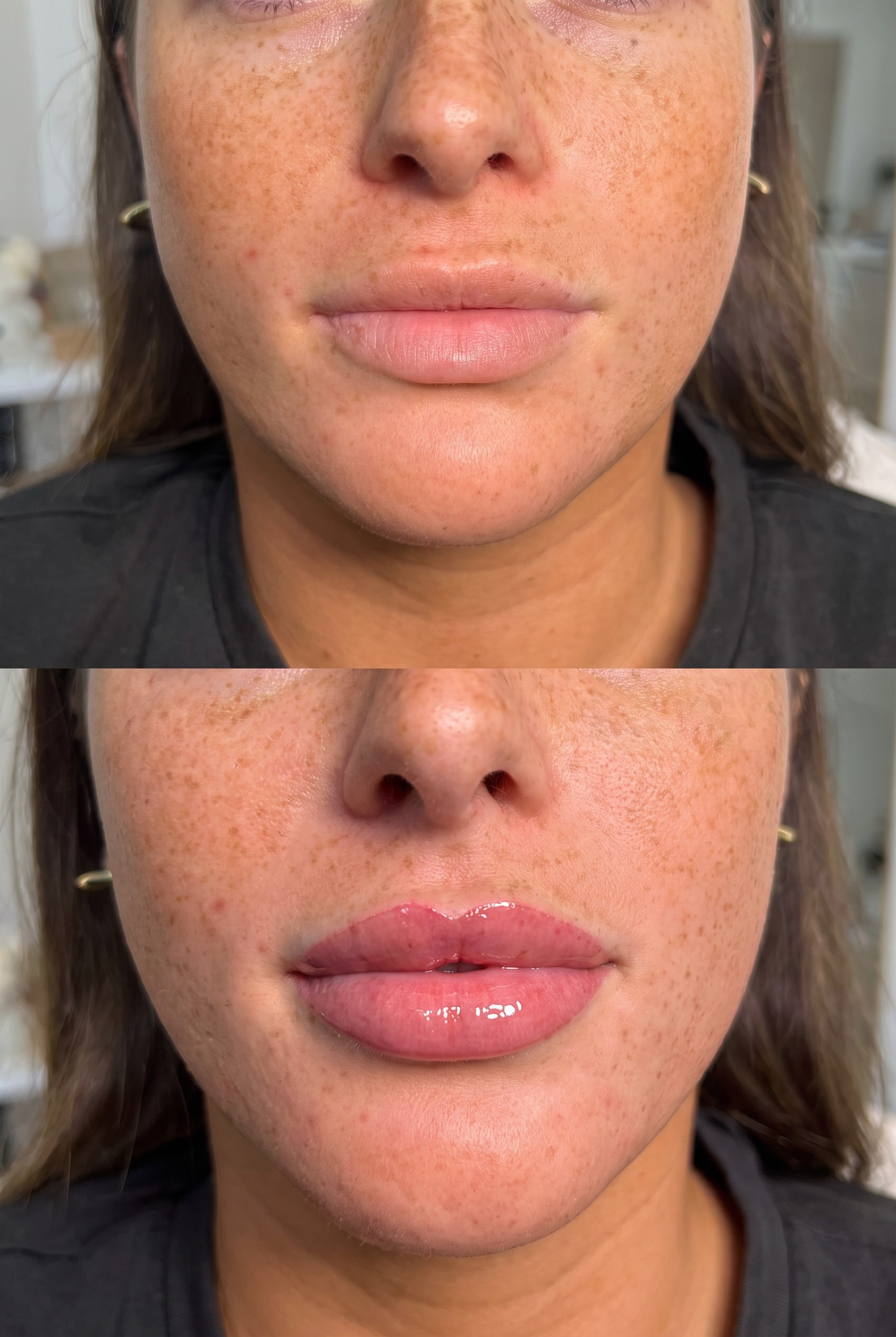 Lippen vor und nach PMU Lip Blush Permanent Make-up bei JOLIYOU Hamburg