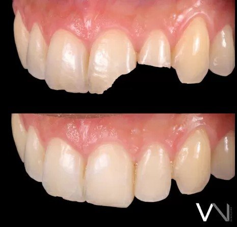 Dentisteria operatória