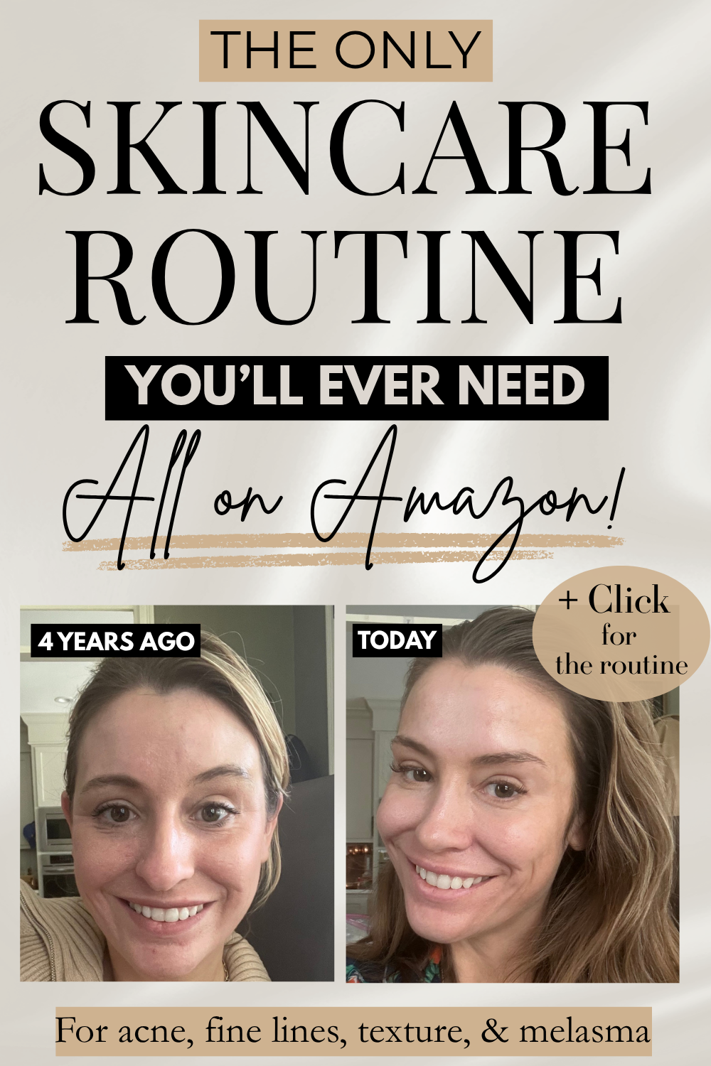 The Only Skincare Routine You’ll Ever Need (All on Amazon)