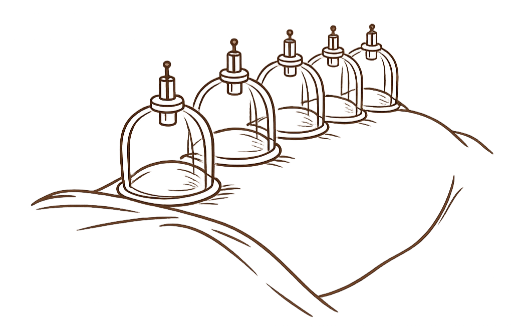 Cupping therapy