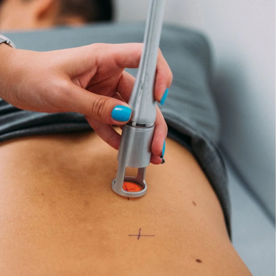 A person with blue painted nails holds a cosmetic or medical instrument, applying it to a person's chest with marked lines and marks, in a clinical setting.