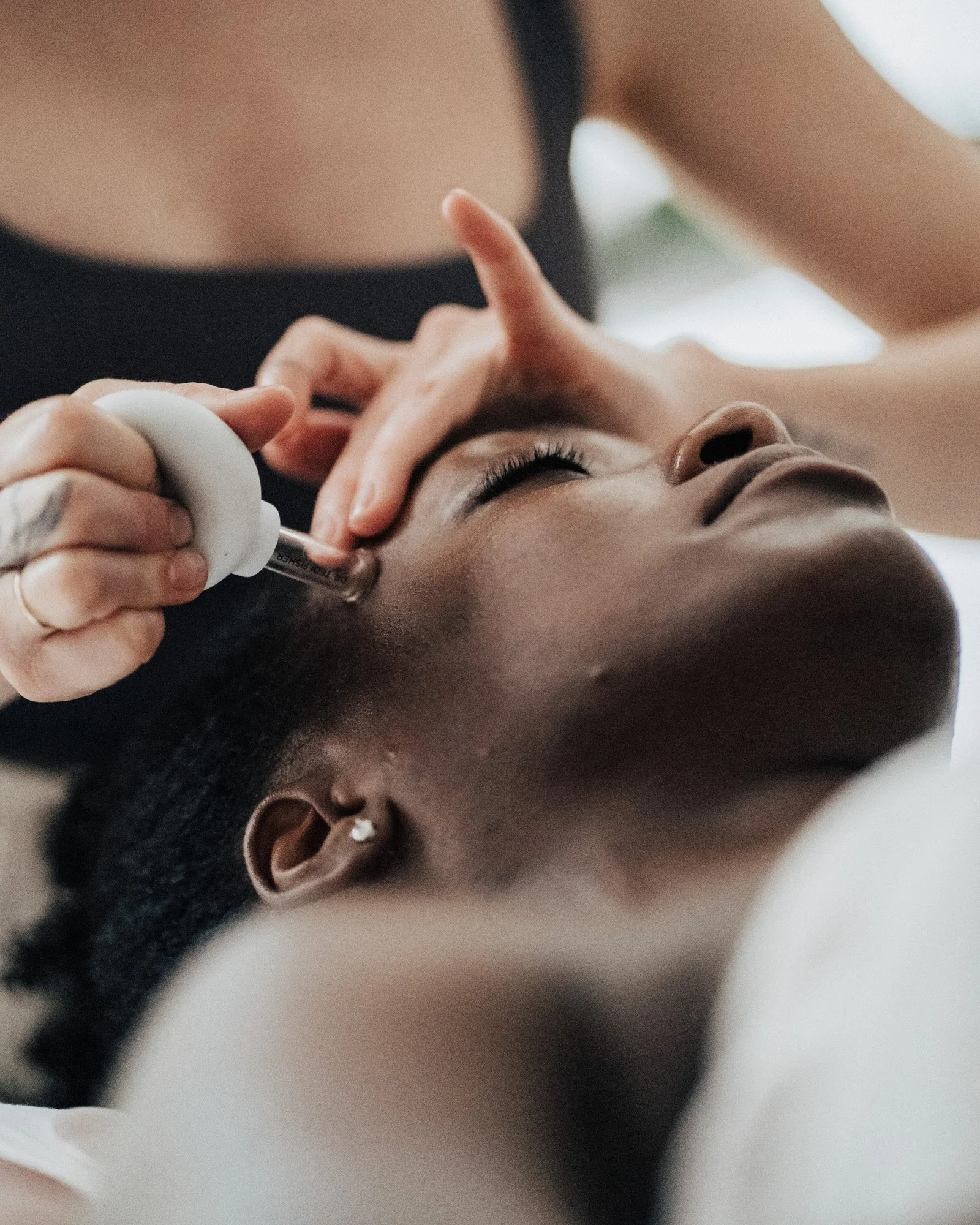 cupping acupuncture suction gastown