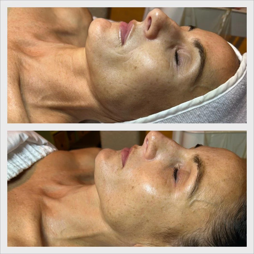 Circadia Luxe Lift Facial