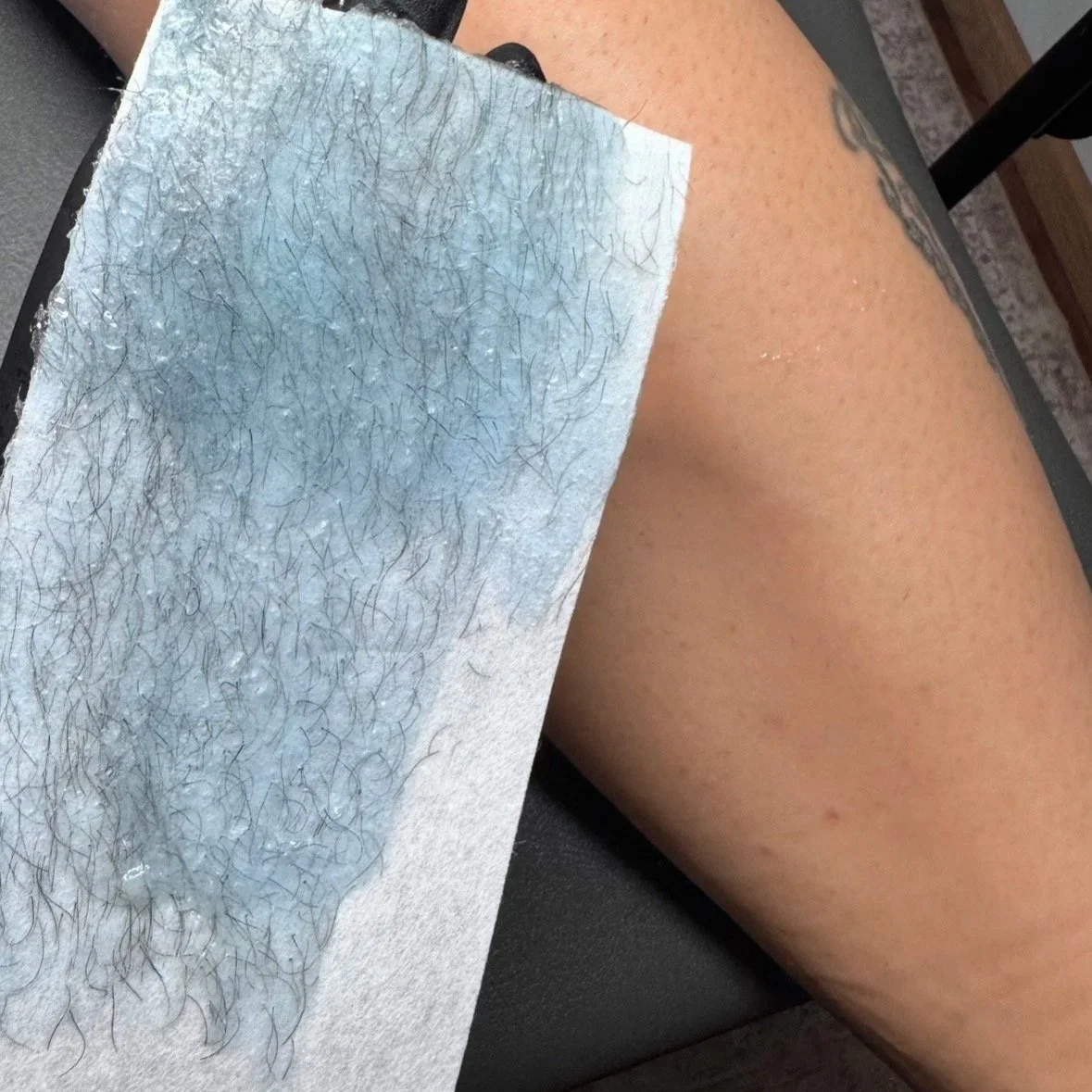 Close-up of a person's leg during a hair removal procedure with a wax strip on the skin, revealing stored hair follicles.