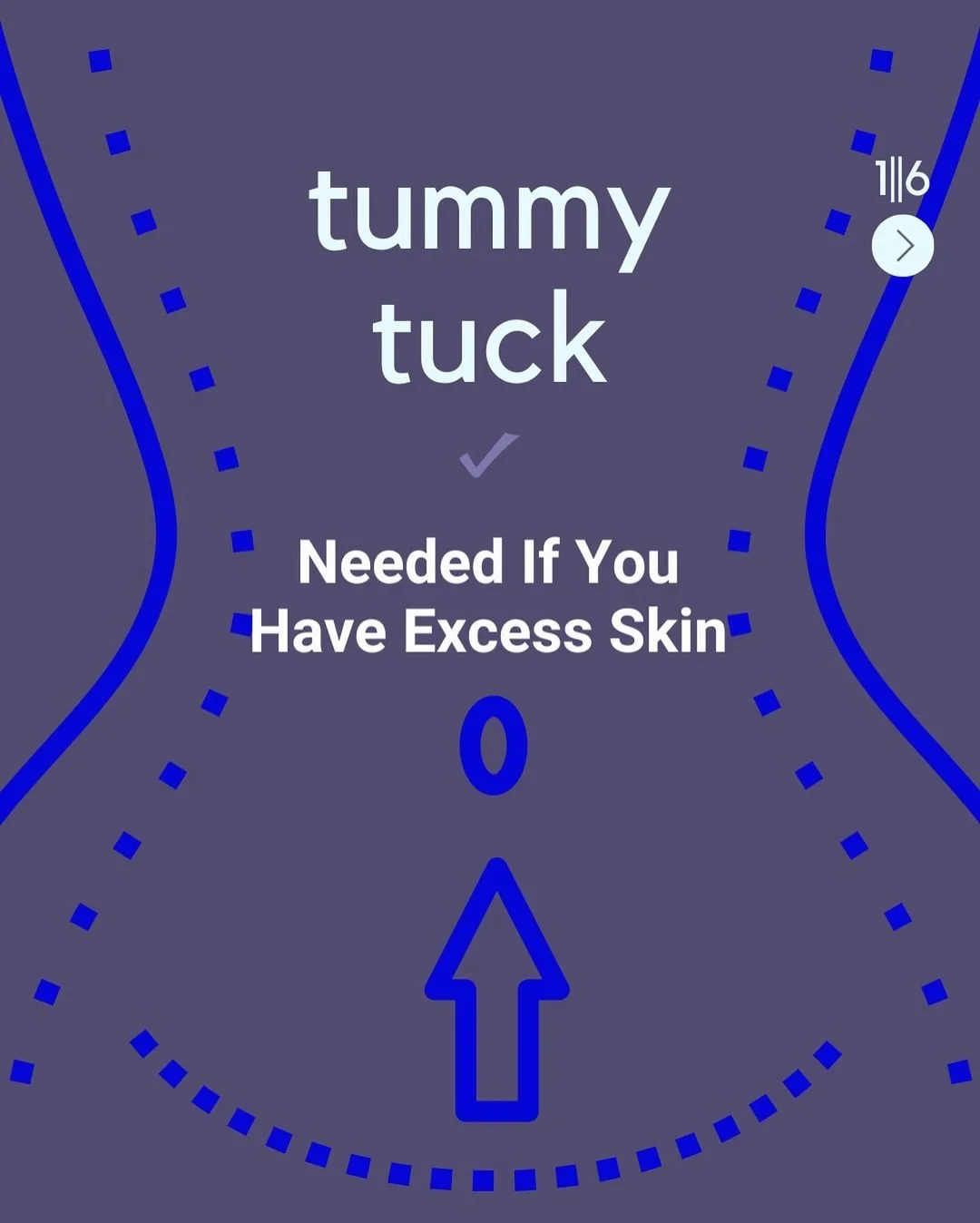 Secret of a Flawless Tummy: When is a Tummy Tuck Necessary?