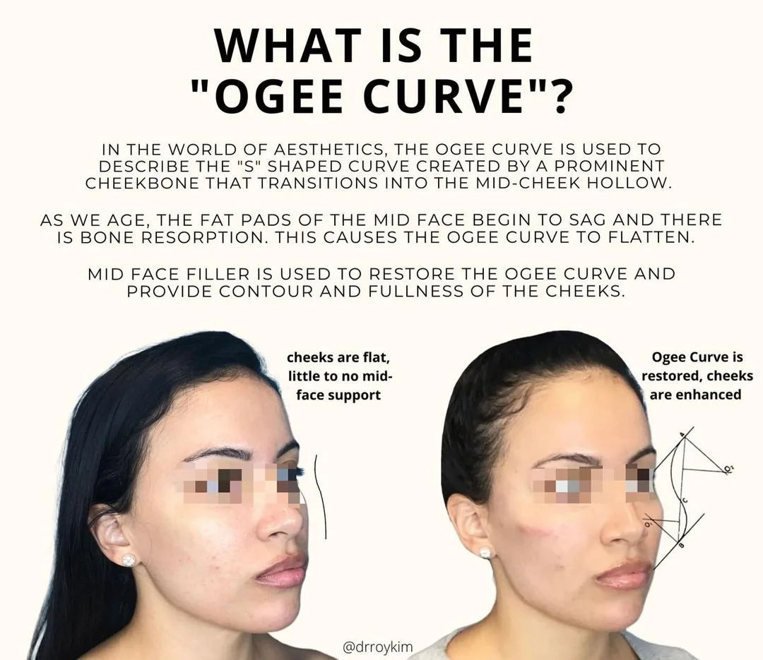The Ogee Curve: Defining Beauty in Facial Aesthetics