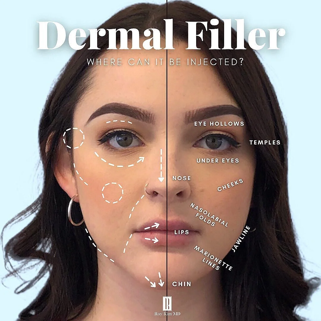 Decoding Aesthetics: Dermal Fillers vs. Botox - A Quick Guide