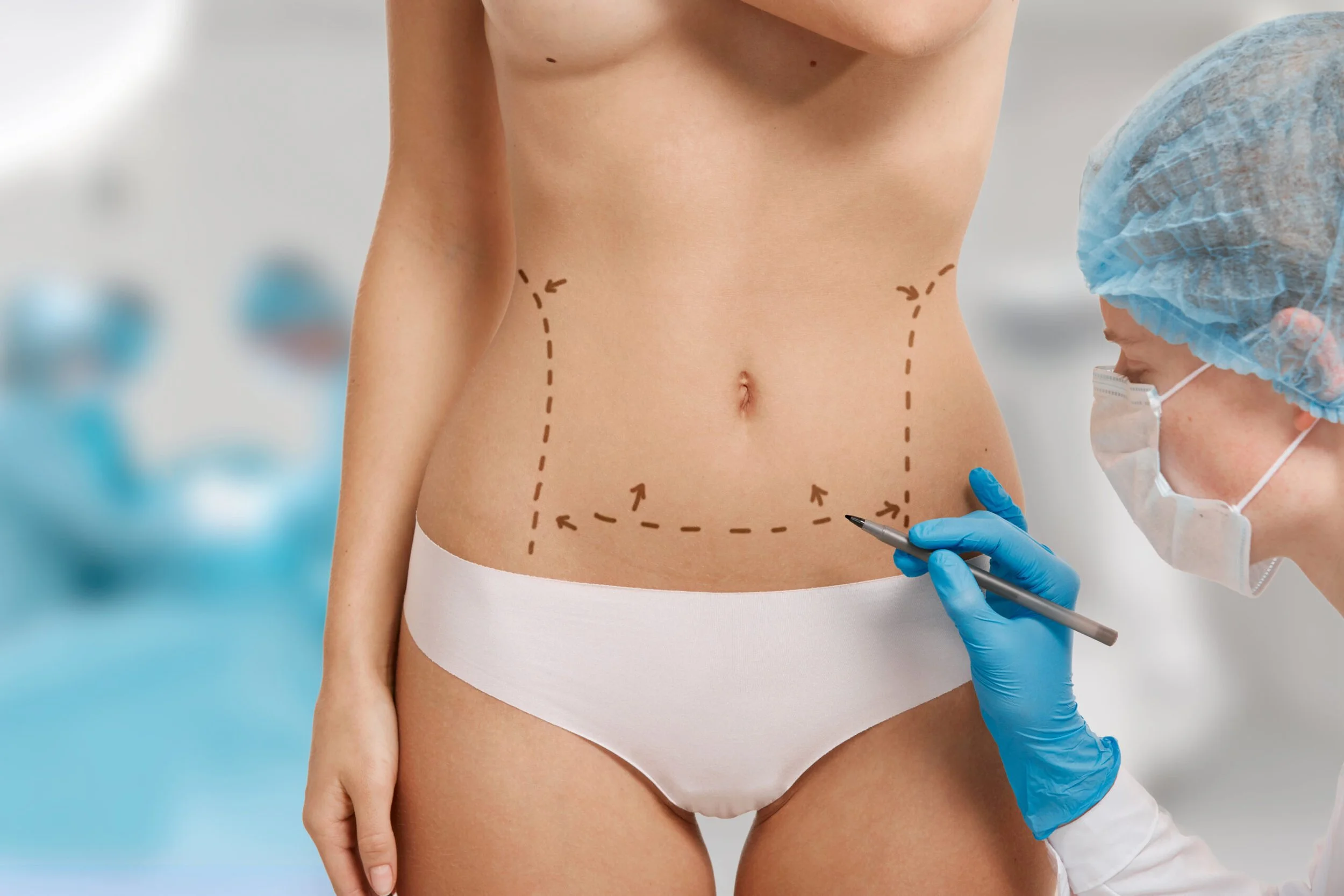 Types of Abdominoplasty: Are You A Candidate?