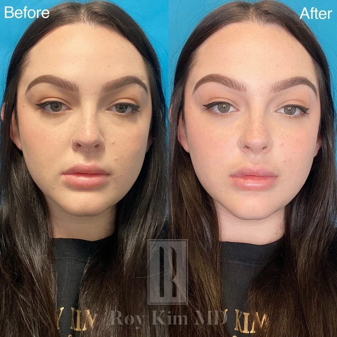 Understanding Photo Manipulation in Cosmetic Procedures