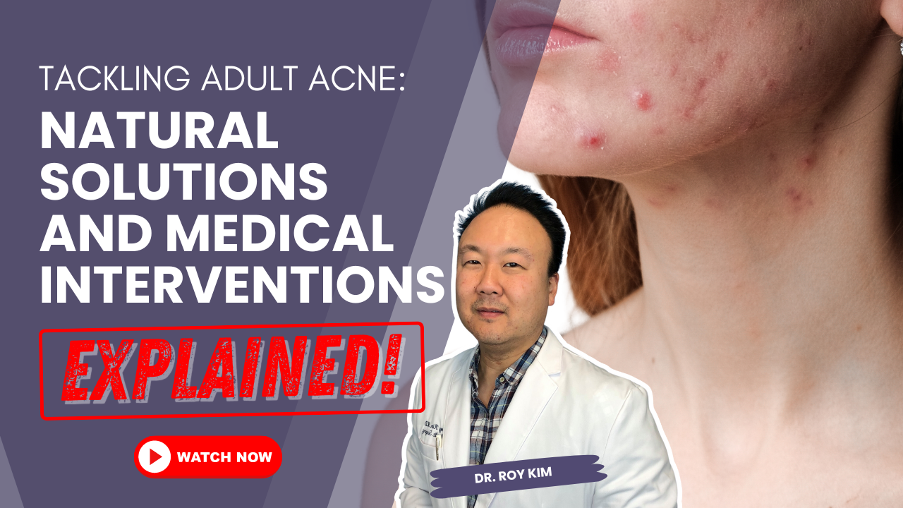 Tackling Adult Acne: Natural Solutions and Medical Interventions Explained
