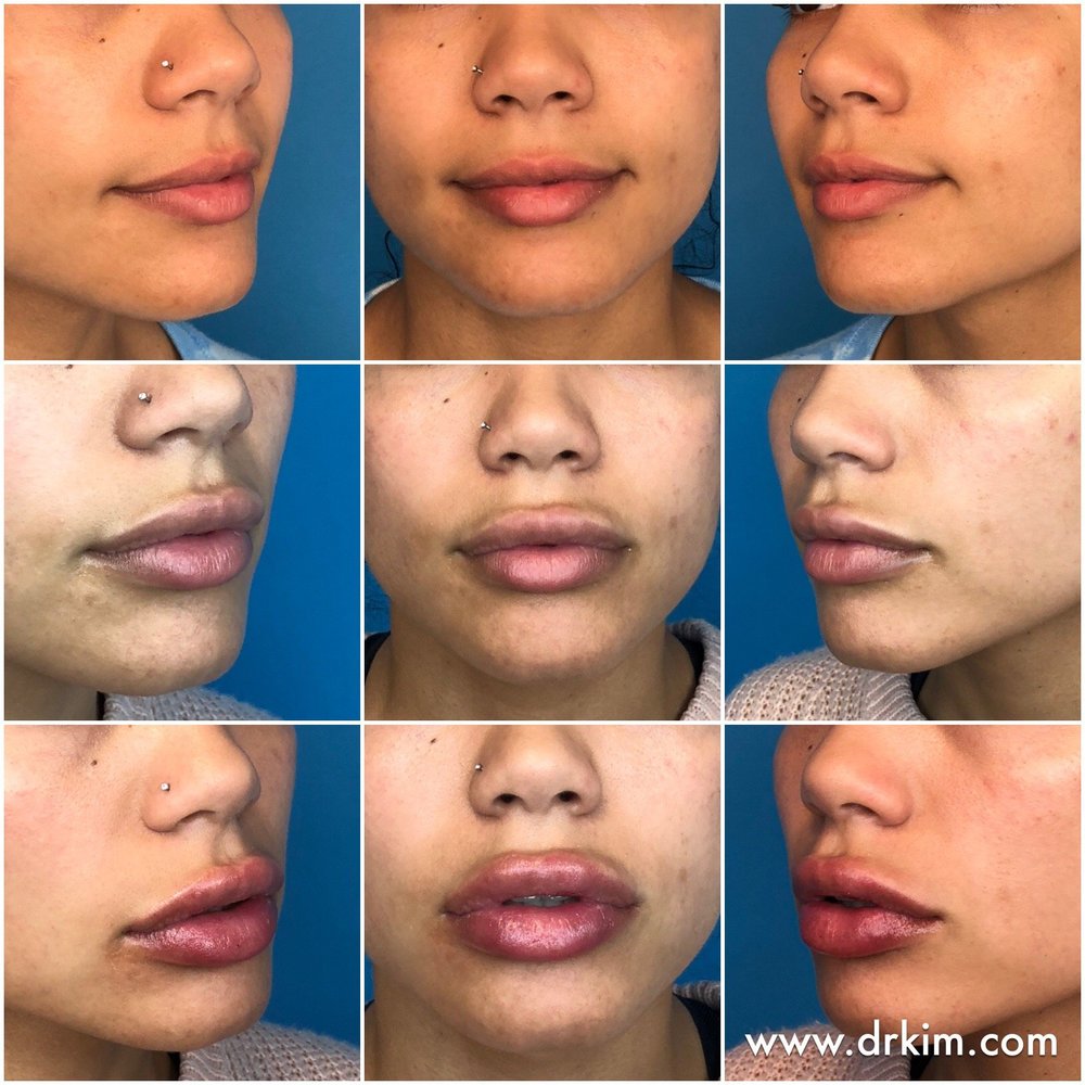 Roy Kim, MD. Plastic Surgeon in San Francisco and Beverly Hills