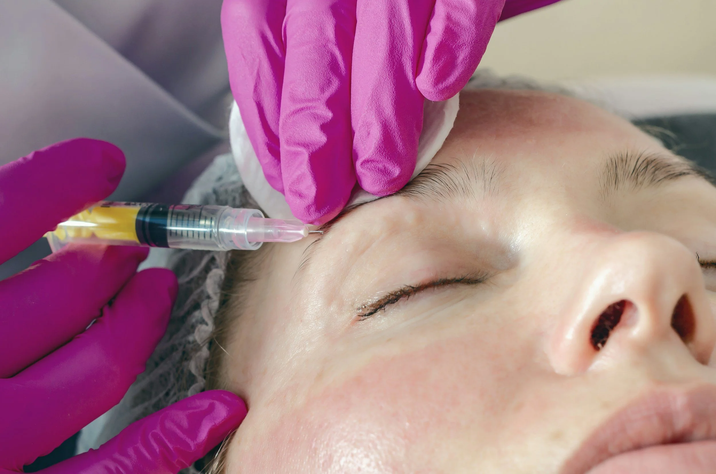 Preventative Botox in Alameda: What Age Should You Start?