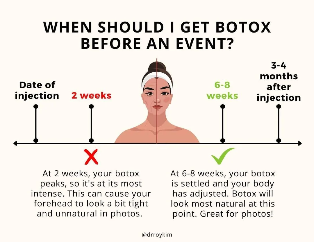 When Should I Get Botox Done?