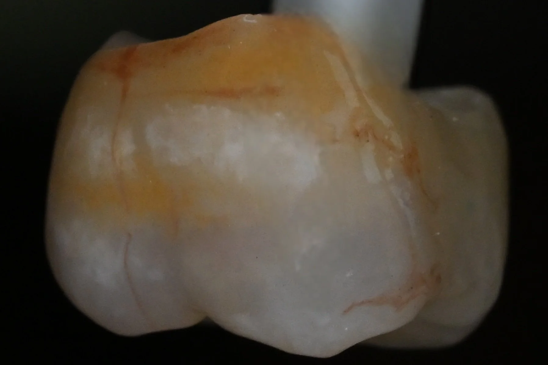 Posterior_Zirconia_Crown_No_Model_2.jpg