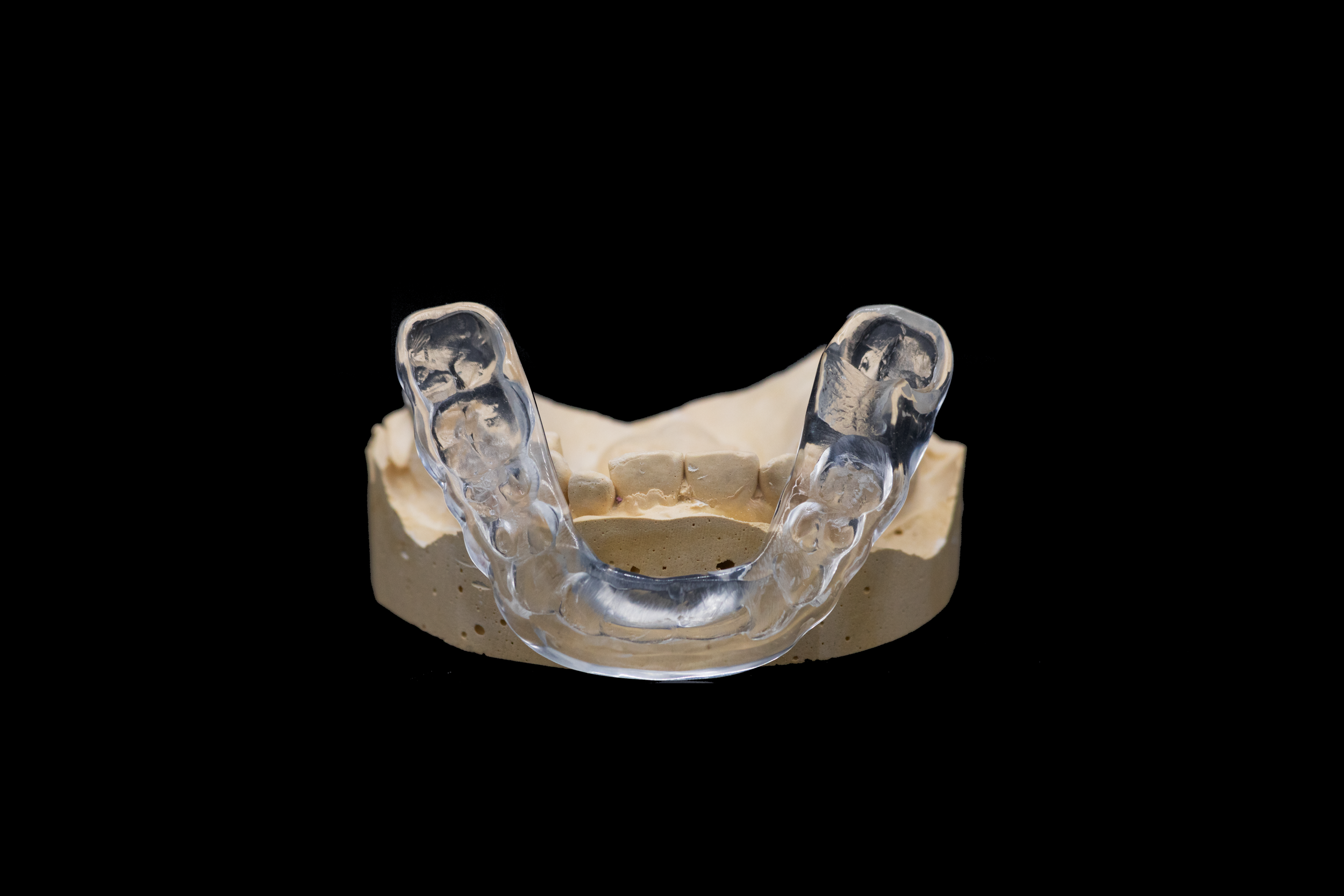 3D Printed Bruxism Guard