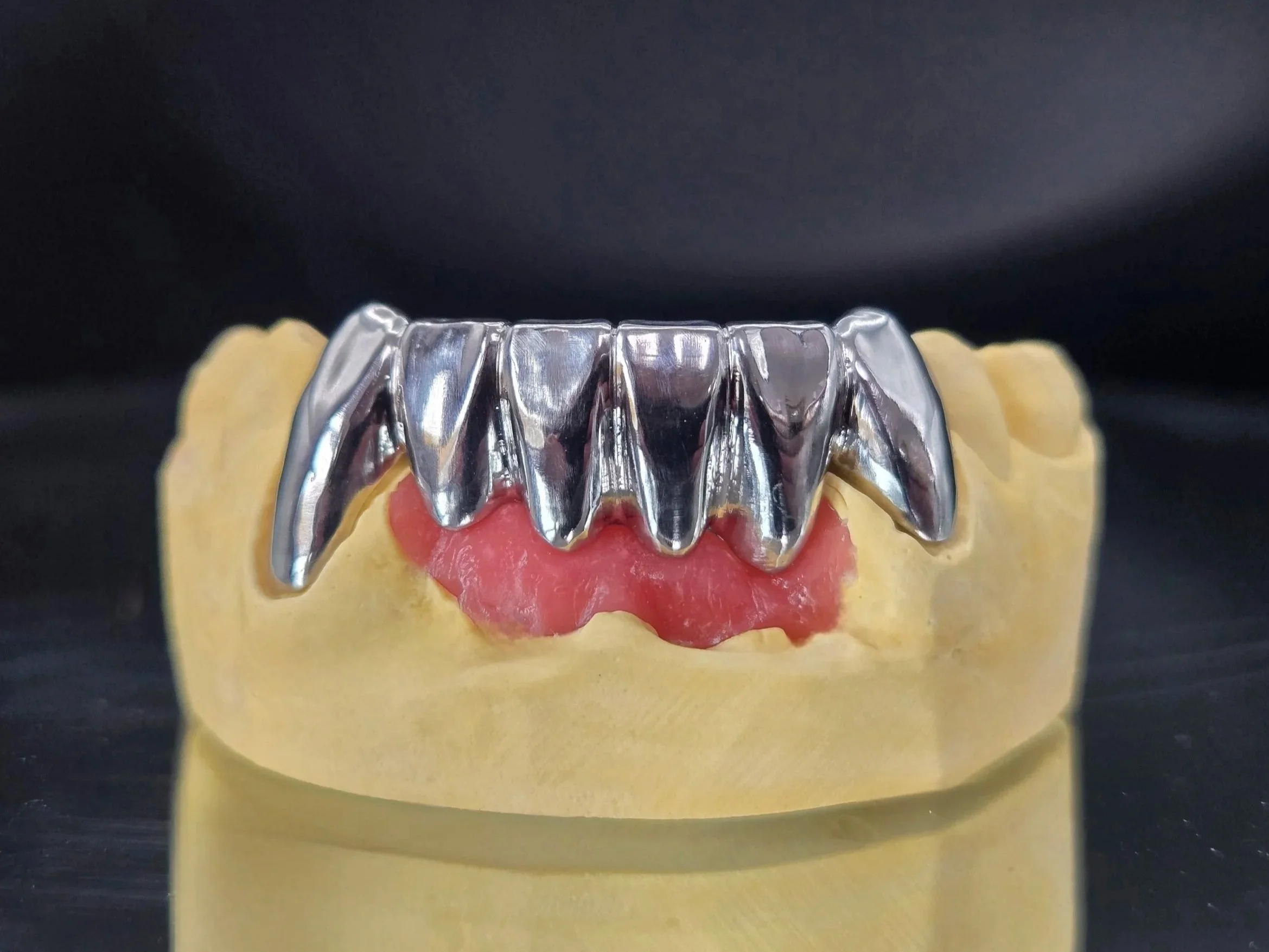 High-Noble_Milled_Anterior_Gold_Bridge_Front_View_1.jpg
