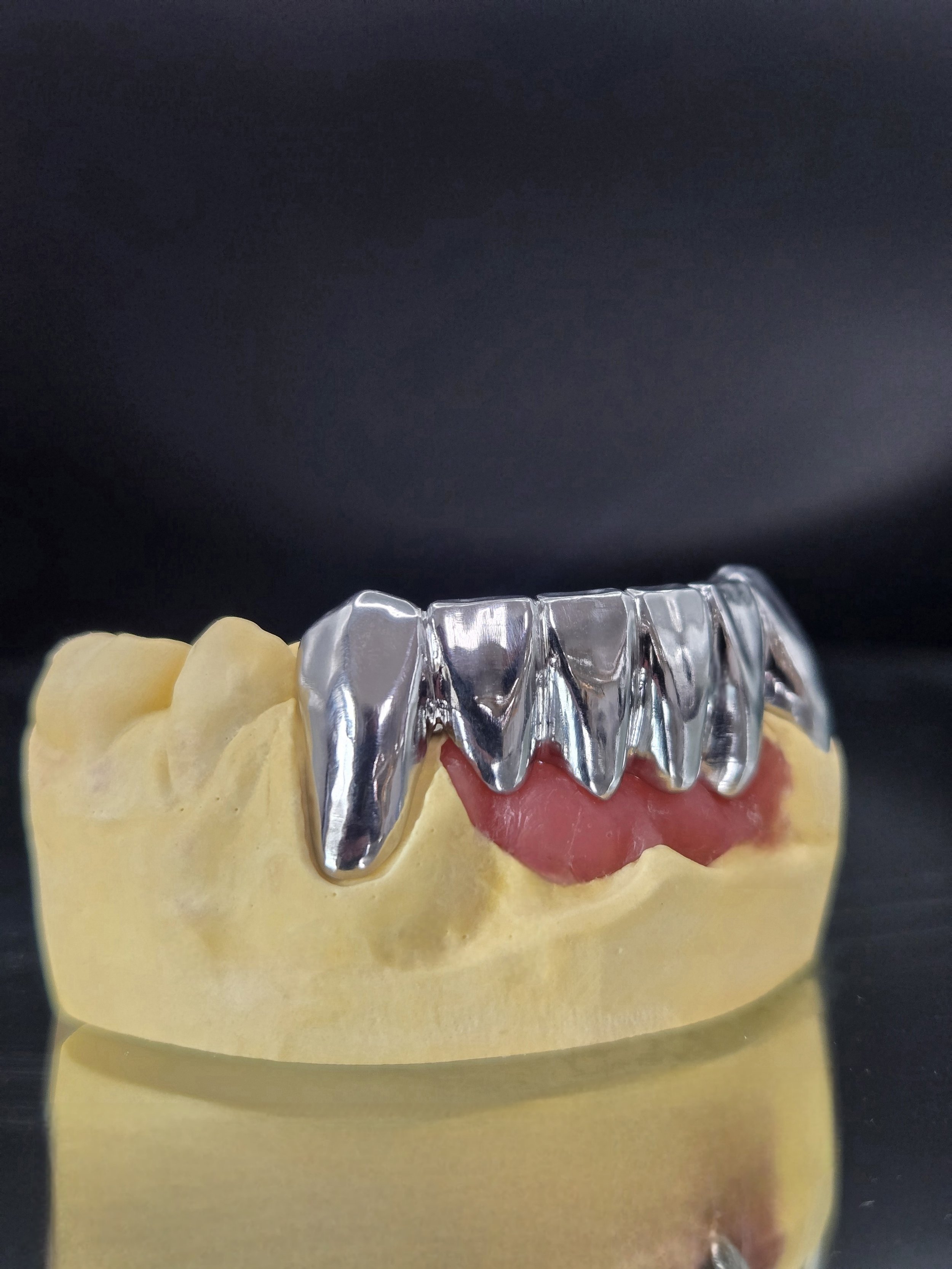 High-Noble_Milled_Anterior_Gold_Bridge_Left_View.jpg