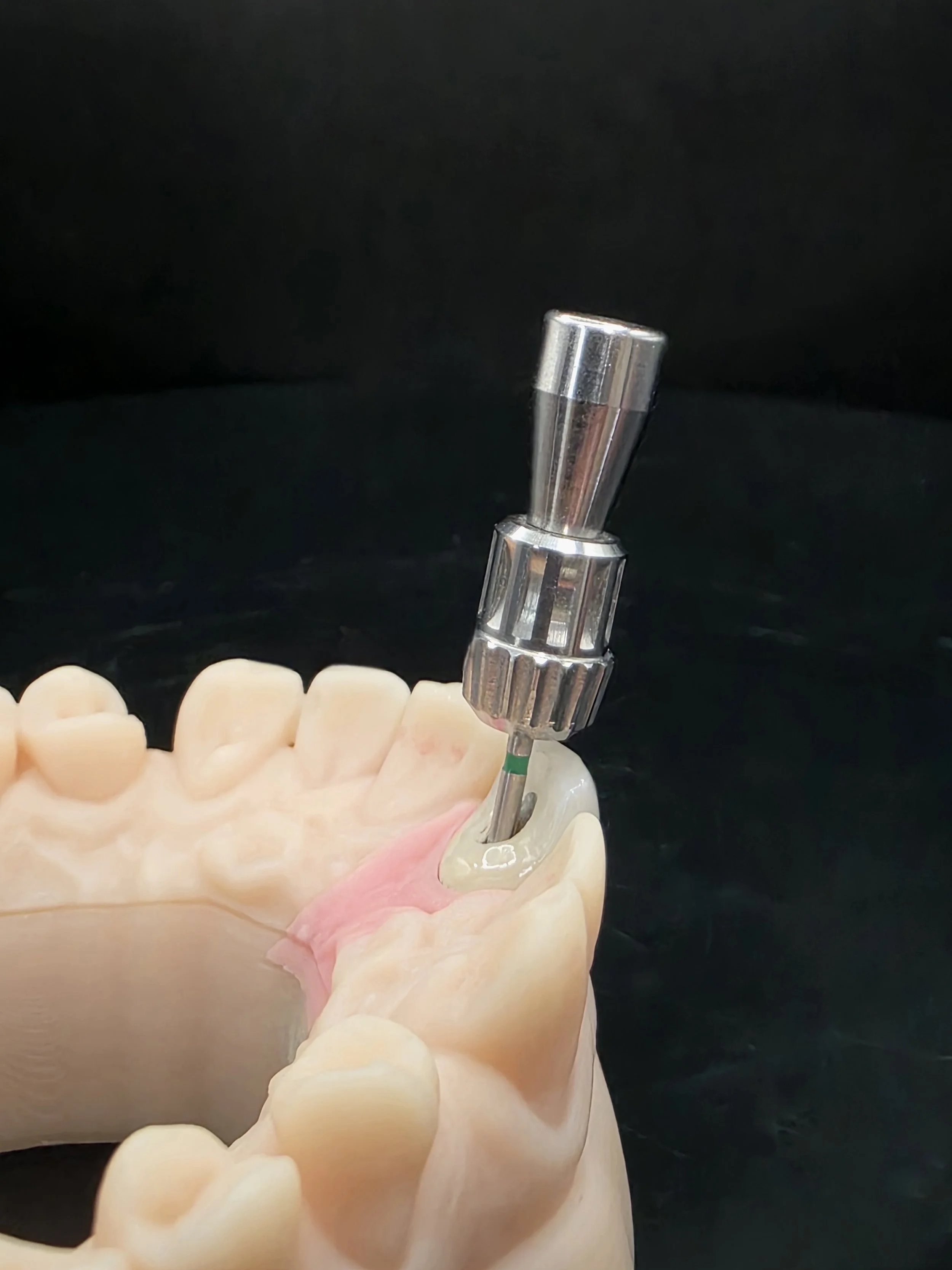 Anterior_Zirconia_Angulated_Implant_Crown_Lingual.jpg