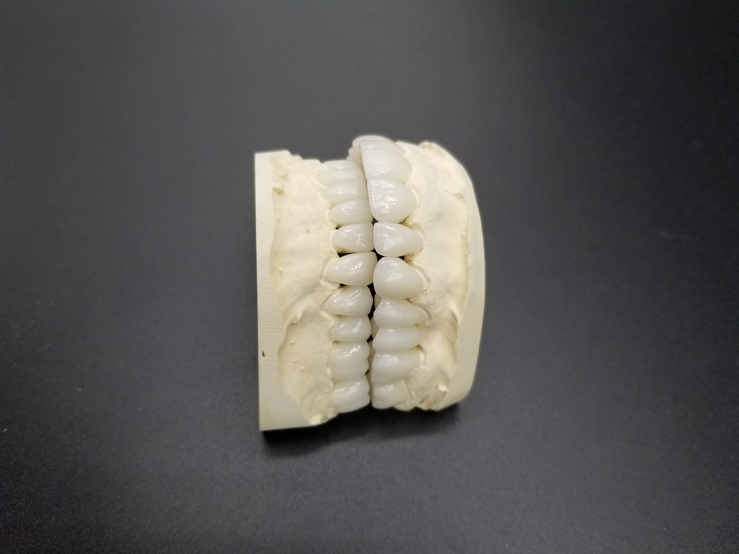 Full Mouth Rehabilitation