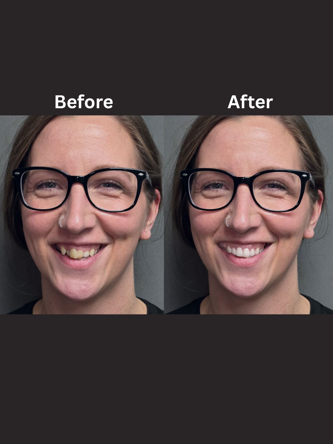 Virtual Smile Design