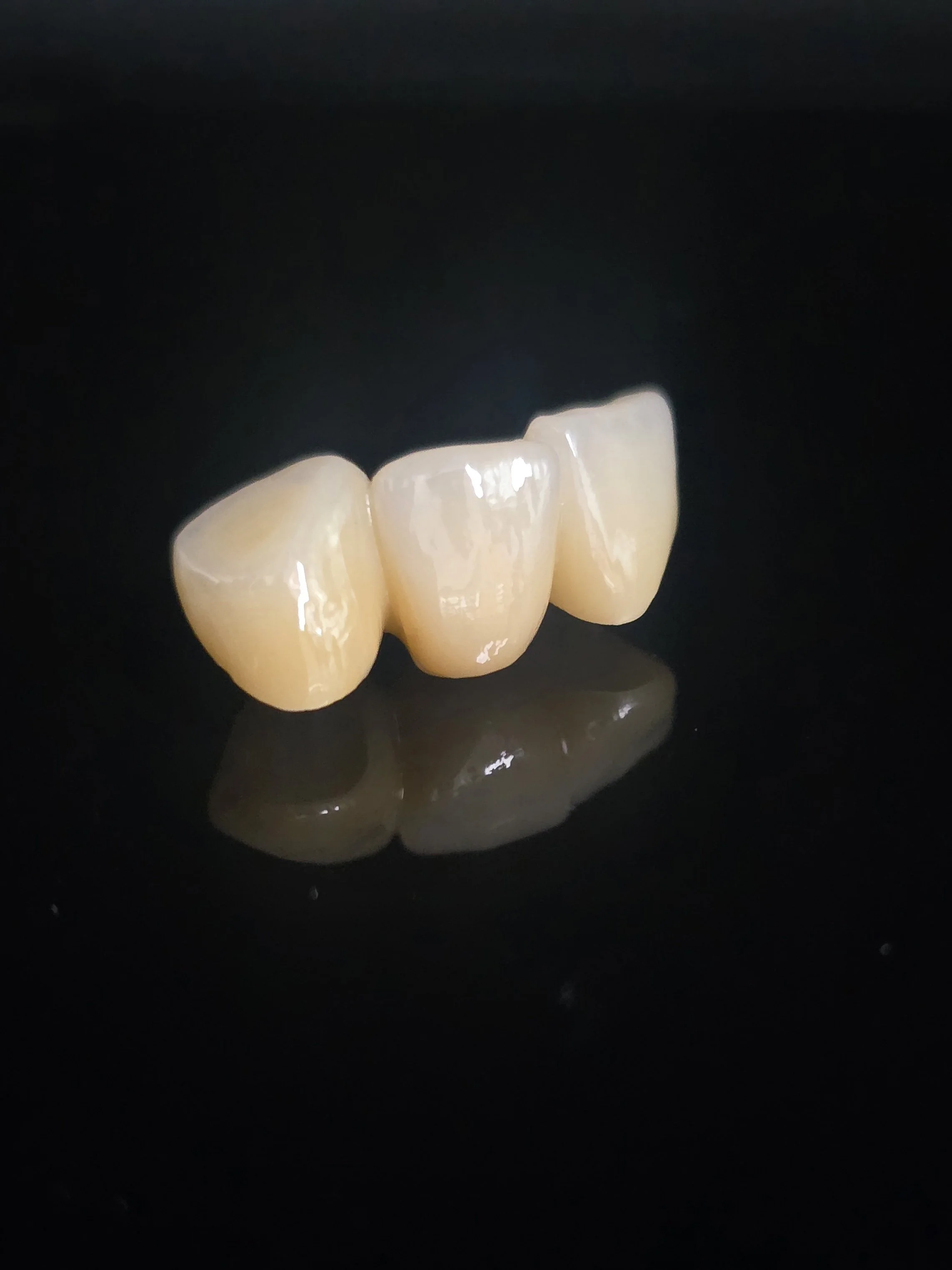Full Contour Zirconia Crown & Bridge
