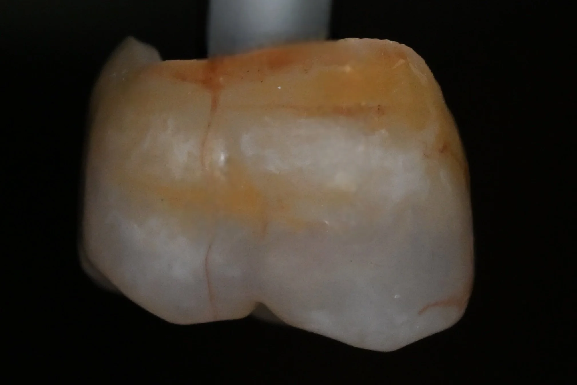 Posterior_Zirconia_Crown_No_Model_1.jpg